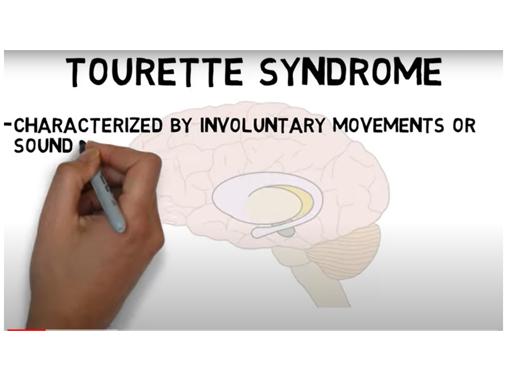 ‘’2-Minute Neuroscience: Tourette Syndrome’’
